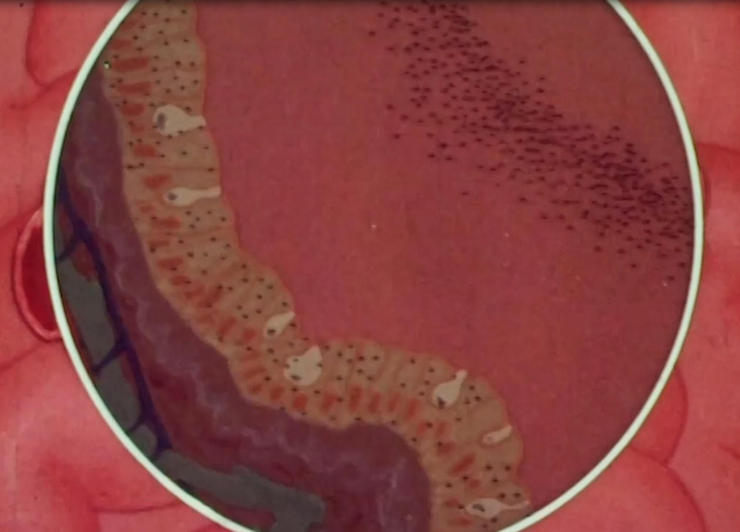 同筑健康防线丨曾让无数孩子致残的病毒 虽已“清零”，但需警惕